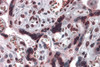 Immunohistochemistry of CARMA2 in human placenta tissue with CARMA2 antibody at 5 &#956;g/mL.