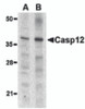 Western blot analysis of caspase-12 in mouse (lane A) and rat (lane B) liver lysate with caspase-12 antibody (small) at 1 &#956;g/mL.