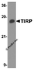 Western blot analysis of TIRP in PC-3 cell lysate with TIRP antibody at 1 &#956;g/mL.