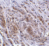 Immunohistochemistry of TRIM5 gamma in human bladder tissue with TRIM5 gamma antibody at 2 ug/mL.