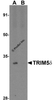 Western blot analysis of TRIM5 delta in human kidney tissue lysate with TRIM5 delta antibody at 1 &#956;g/ml in (A) the absence and (B) the presence of blocking peptide.