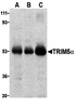 Western blot analysis of TRIM5 alpha expression in (A) human stomach, (B) thymus, and (C) uterus tissue lysate with TRIM5 alpha antibody at 2 &#956;g/ml.