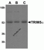 Western blot analysis of TRIM5 alpha expression in human stomach (A) , thymus (B) , and uterus (C) cell lysate with TRIM5 alpha antibody at 2 &#956;g/mL.