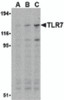 Western blot analysis of TLR7 in Daudi cell lysates with TLR7 antibody at (A) 0.5, (B) 1, and (C) 2 &#956;g/mL.