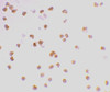 Immunocytochemistry staining of Daudi cells using TLR7 antibody at 2 ug/mL.