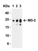 Figure 1 Western Blot Validation with Recombinant Protein
Loading: 30 ng of human MD-2 recombinant protein per lane.
Antibodies: MD-2, 3289 (Lane 1: 0.5 &#956;g/mL, Lane 2: 1 &#956;g/mL and Lane 3: 2 &#956;g/mL) , 1h incubation at RT in 5% NFDM/TBST.
Secondary: Goat anti-rabbit IgG HRP conjugate at 1:10000 dilution.