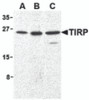 Western blot analysis of TIRP in human (A) , mouse (B) , and rat (C) kidney cell lysates with TIRP antibody (C2) at 1 &#956;g/mL.