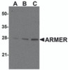 Western blot ana-lysis of ARMER in mouse small intestine tissue lysates with ARMER antibody at (A) 0.5, (B) 1, and (C) 2 &#956;g/mL.