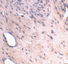 Immunohistochemical staining of human bladder tissue using ARMER antibody at 2 ug/mL.