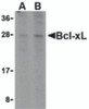 Western blot analysis of Bcl-xL in A549 cell lysates with Bcl-xL antibody at (A) 1 and (B) 2 &#956;g/mL.