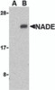 Western blot analysis of NADE in Human brain cell lysates with NADE antibody at 1 &#956;g/mL in the presence (A) or absence (B) of blocking peptide.
