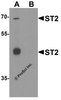 Western blot analysis of ST2 in 293 cell lysate with ST2 antibody at 1 &#956g/ml in (A) the absence and (B) the presence of blocking peptide.