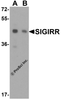 Western blot analysis of SIGIRR expression in (A) A549 and (B) MCF7 cell lysate with SIGIRR antibody at  1 &#956;g/ml.