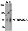 Western blot analysis of TRIAD3A in mouse heart tissue lysate with TRIAD3A antibody at (A) 1 and (B) 2 &#956;g/mL.