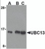 Western blot analysis of UBC13 in human small intestine cell lysates with UBC13 antibody at (A) 0.5, (B) 1, and (C) 2 &#956;g/mL.