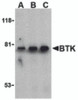 Western blot analysis of BTK in U937 cell lysate with BTK antibody at (A) 0.5, (B) 1, and (C) 2 &#956;g/mL.