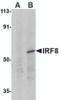 Western blot analysis of IRF8 in human thymus tissue lysate with IRF8 antibody at 1&#956;g/mL in (A) the presence and (B) absence of blocking peptide.