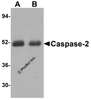 Western blot analysis of Caspase-2 in (A) human thymus tissue and (B) human kidney lysate with Caspase-2 antibody at 1 &#956;g/mL.