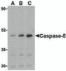 Western blot analysis of caspase-5 in Ramos cells with caspase-5 antibody at (A) 0.5, (B) 1, and (C) 2 &#956;g/mL.