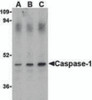 Western blot analysis of Caspase-1 in HeLa cell lysate with Caspase-1 antibody (IN) at (A) 0.5, (B) 1, and (C) 2 &#956;g/mL.