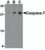 Western blot analysis of Caspase-7 in human skeletal muscle cell lysate with Caspase-7 antibody at (A) 0.5, (B) 1, and (C) 2 &#956;g/mL.