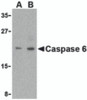 Western blot analysis of Caspase-6 in MCF7 cell lysate with Caspase-6 antibody (IN) at (A) 1 and (B) 2 &#956;g/mL.