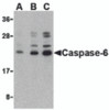 Western blot analysis of caspase-6 in Jurkat cell lysate with caspase-6 antibody at (A) 0.5, (B) 1, and (C) 2 &#956;g/mL.