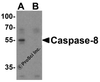 Western blot analysis of caspase-8 in Jurkat cell lysate with caspase-8 antibody at 1 &#956;g/mL in (A) the absence and (B) the presence of blocking peptide.