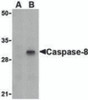 Western blot analysis of Caspase-8 in HT-29 cell lysate with Caspase-8 antibody (IN) at 1 &#956;g/mL in (A) the presence or (B) the absence of blocking peptide.