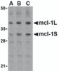 Western blot analysis of Mcl-1 in Raji cell lysates with Mcl-1 antibody (IN) at (A) 0.5, (B) 1, and (C) 2 &#956;g/mL.