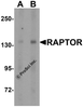 Western blot analysis of Raptor in L1210 cell lysate with Raptor antibody at (A) 2 and (B) 4 &#956;g/mL.