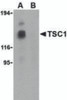 Western blot analysis of TSC1 in EL4 cell lysate with TSC1 antibody at 1 &#956;g/mL in the (A) absence and (B) presence of blocking peptide.