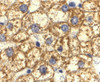 Immunohistochemistry of Akt1 in human liver cells with Akt1 antibody at 2 ug/mL.