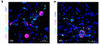 Figure 1 Immunofluorescent Validation of 3525 in SARS-CoV-2 Infected Lung Tissue (Singh et al., Nature Microbiology, 2021) Multilabel confocal immunofluorescence microscopy of formalin-fixed paraffin-embedded lung sections from rhesus macaques infected with SARS-CoV-2. SARS-CoV-2 spike-specific antibodies, 3525 ProSci Inc. (k, n) (turquoise) ; Ki67 (magenta) and neutrophil marker CD66abce (yellow) (k) ; pan-macrophage marker CD68 (magenta) (n) and DAPI (blue) .