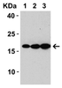 Figure 1 Western Blot Validation with SARS-CoV-2 Matrix Recombinant ProteinLoading: SARS-CoV-2 Matrix recombinant protein. Antibodies: SARS-CoV-2/SARS-CoV Matrix (1 &#956;g/mL) , 1h incubation at RT in 5% NFDM/TBST. Secondary: Goat anti-rabbit IgG HRP conjugate at 1:10000 dilution. Lane 1: 10 ng Matrix protein, Lane 2: 25 ng Matrix protein and Lane 3: 50 ng Matrix protein.