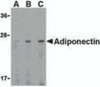 Western blot analysis of adiponectin in HL60 cell lysate with adiponectin antibody at (A) 0.5, (B) 1, and (C) 2 &#956;g/mL.