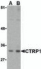 Western blot analysis of CTRP1 in MDA-MD-361 cell lysate with CTRP1 (IN) antibody at (A) 1 and (B) 2 &#956;g/mL.