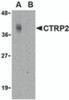 Western blot analysis of CTRP2 in Caco-2 cell lysate with CTRP2 antibody at 1 &#956;g/mL in either the (A) absence or (B) presence of blocking peptide.