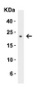 Figure 2 Western Blot Validation with Recombinant Protein
Loading: 30 ng of human CTRP3 recombinant protein per lane.
Antibodies: CTRP3, 3565 (2 ug/mL) , 1h incubation at RT in 5% NFDM/TBST.
Secondary: Goat anti-rabbit IgG HRP conjugate at 1:10000 dilution.