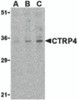 Western blot analysis of CTRP4 in rat brain cell lysate with CTRP4 antibody at (A) 1, (B) 2, and (C) 4 &#956;g/mL.