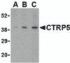 Western blot analysis of CTRP5 in caco-2 cell lysate with CTRP5 antibody at (A) 1, (B) 2, and (C) 4 &#956;g/mL.