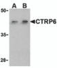 Western blot analysis of CTRP6 in HeLa cell lysate with CTRP6 antibody at (A) 1 and (B) 2 &#956;g/mL.