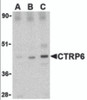 Western blot analysis of CTRP6 in mouse brain cell lysate with CTRP6 antibody at (A) 0.5, (B) 1 and (C) 2 &#956;g/mL.