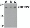 Western blot analysis of CTRP7 in 293 cell lysate with CTRP7 antibody at (A) 0.5, (B) 1, and (C) 2 &#956;g/mL.