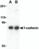 Western blot analysis of T-cadherin in 3T3 lysate with T-cadherin antibody at (A) 0.5 and (B) 1 &#956;g/mL.