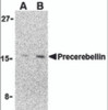 Western blot analysis of precerebellin in 293 cell lysate with precerebellin antibody at (A) 2 and (B) 4 &#956;g/mL.
