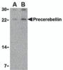 Western blot analysis of precerebellin in mouse cerebellum lysate with precerebellin antibody at (A) 2 and (B) 4 &#956;g/mL.