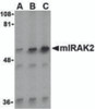 Western blot analysis of IRAK2 in A-20 whole cell lysate with IRAK2 antibody (C2) at (A) 0.5, (B) 1, and (C) 2 &#956;g/mL.