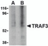 Western blot analysis of TRAF3 in 3T3 cell lysate with TRAF3 antibody at (A) 1, and (B) 2 &#956;g/mL.