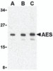 Western blot analysis of AES in 293 cell lysate with AES antibody at (A) 1, (B) 2 and (C) 4 &#956;g/mL.
